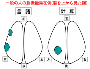 脳機能局在例